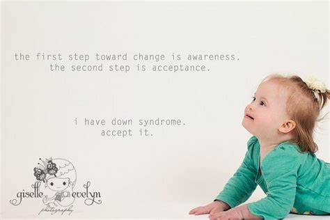 Cute Down Syndrome Quotes Quotesgram