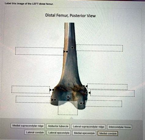 Solved Label This Image Of The Left Distal Femur Distal Femur