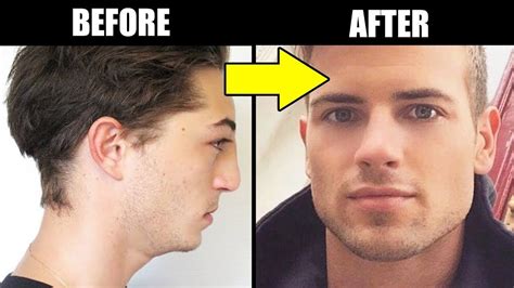 How To Have More Defined Jawline Peinture