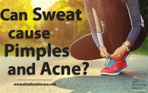 Don't be put off by the name, because, unlike some acids, hyaluronic acid doesn't strip the skin or cause any. Does Sweat Cause Pimples and Acne? | Dr. Cynthia Bailey ...