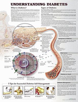 Anatomy Charts Posters Understanding Diabetes Anatomical Chart 3rd