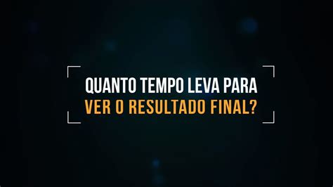 Transplante Capilar Quanto Tempo Para Ver O Resultado Final YouTube