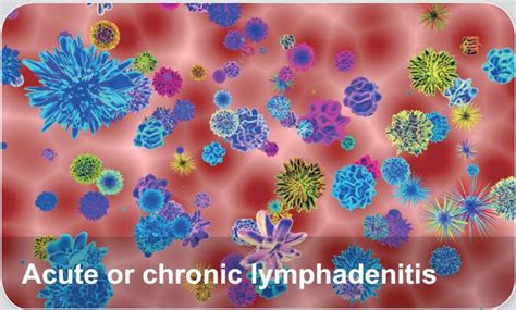 Lymphatic Diseases Acute Or Chronic Lymphangitis Elabscience