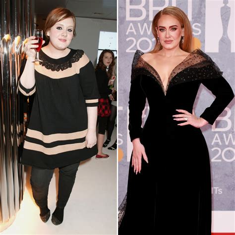 Did Adele Get Plastic Surgery Transformation Photos