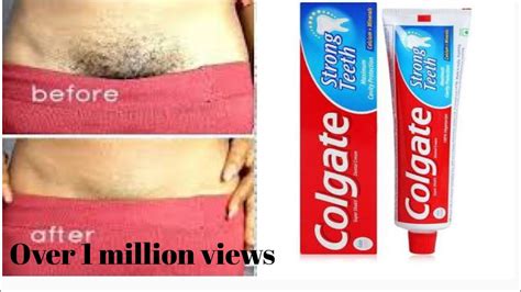 Safe and effective for all hair and skin colors. NO SHAVE! NO WAX! REMOVE All UNWANTED HAIR WITH COLGATE ...