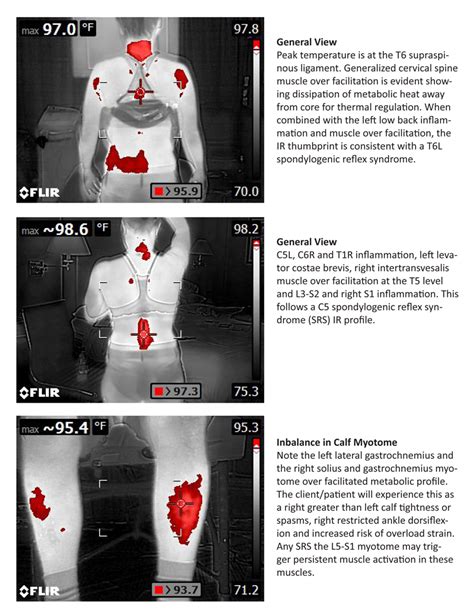 Ir Image Library — Spinal Reflex Institute Intl Copy