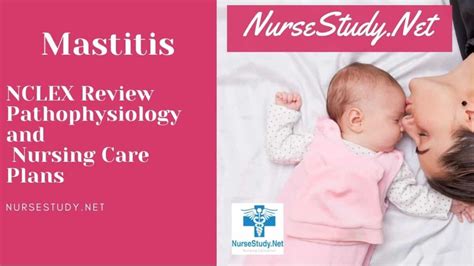 Mastitis Nursing Care Plans And Diagnosis Interventions Nursestudy Net