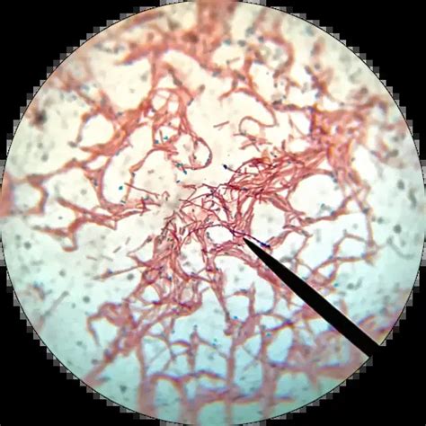 Endospore Stain Understanding Definitions Techniques And Procedures