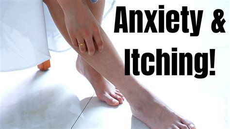 Anxiety And Itchy Skin Psychogenic Itch Youtube