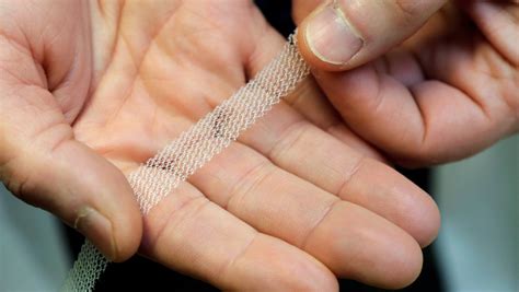 Women With Transvaginal Mesh Implants To Share 215 Million In