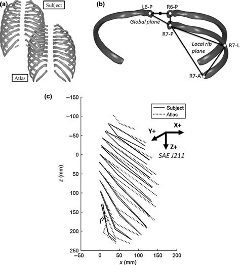 Morphometric Analysis Of Variation In The Ribs With Age And Sex Weaver 2014 Journal Of