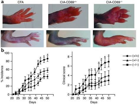 Jci Cd69 Downregulates Autoimmune Reactivity Through Active
