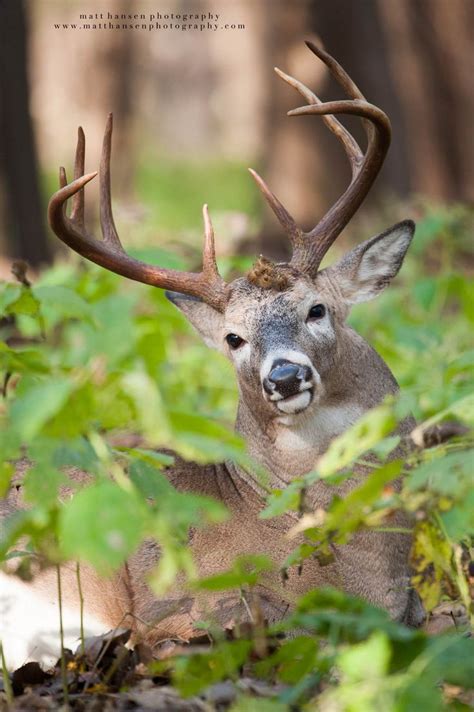 A Heavy Whitetail Buck Beds In A Northern Forest And Looks At The