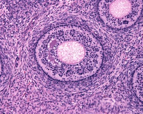Ovarian Follicle Light Micrograph Stock Image C0456637 Science