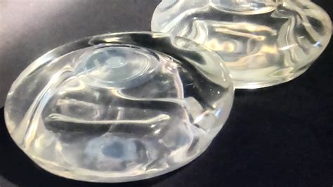 Allergan Recalls Textured Breast Implant Tied To Rare Cancer National Center For Health Research