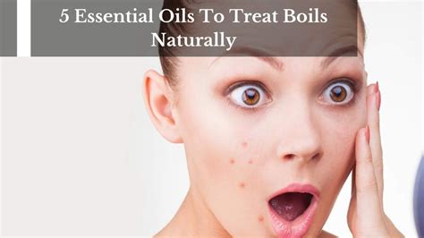 5 Essential Oils To Treat Boils Naturally