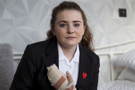 Graphic A 14 Year Old Girl Had Her Finger Amputated After It Was Almost Ripped Off When A