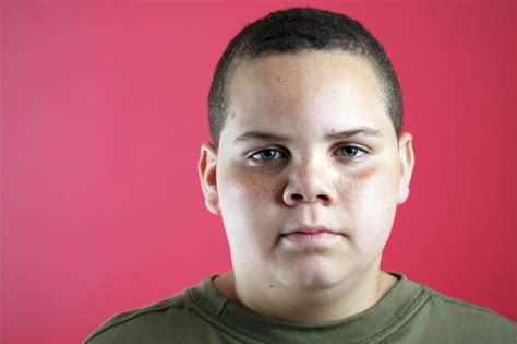 Overweight Kids Take A Lot Of Grief Heres How To Help Inside