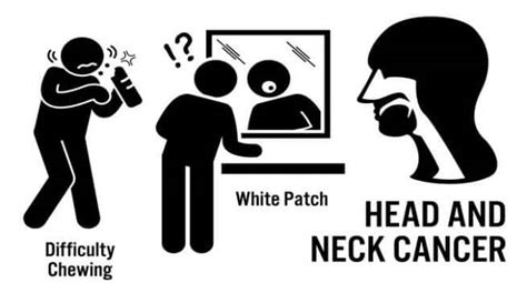 7 Common Symptoms Of Head And Neck Cancer