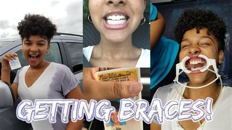 Avoid solid or crunchy foods for a while. Getting Braces on and my Permit! - YouTube