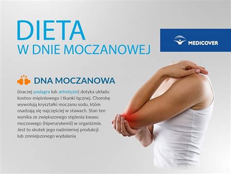 Dna moczanowa | Dieta w dnie moczanowej
