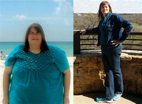 Womans Inspiring Story Of 243 Pound Weight Loss