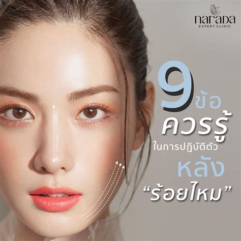 ร้อยไหมจมูก 13 อันดับแรก