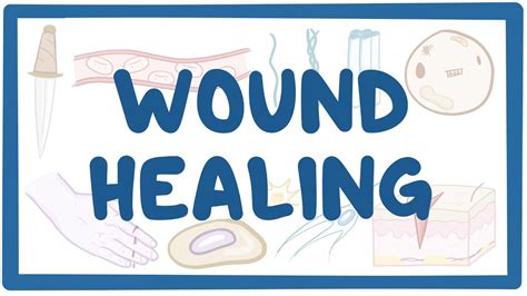 Wound Healing Video Anatomy Definition And Function Osmosis