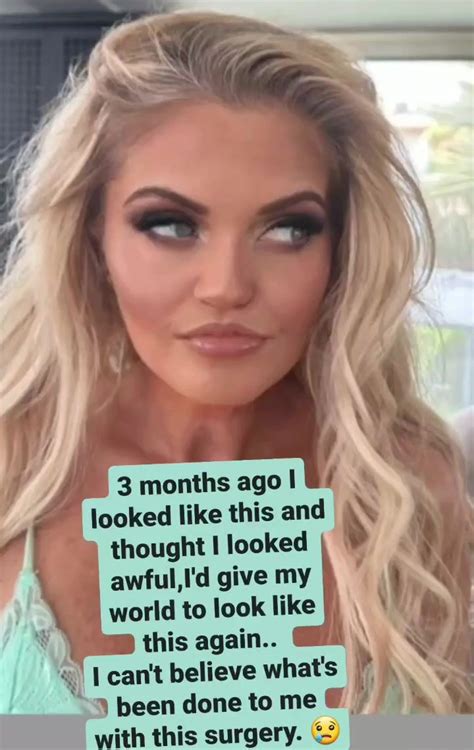 Danniella Westbrook Admits She Hates Her New Face After Surgery Saying