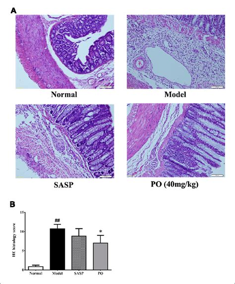 Histological Evaluation For Inflammatory Lesion In Colon Tissue A