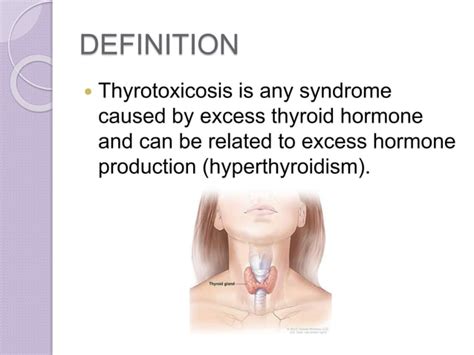 Hyperthyroidism Thyrotoxicosis Pharmacotherapy