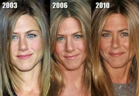 Before And After Plastic Surgery Jennifer Aniston Дженнифер энистон
