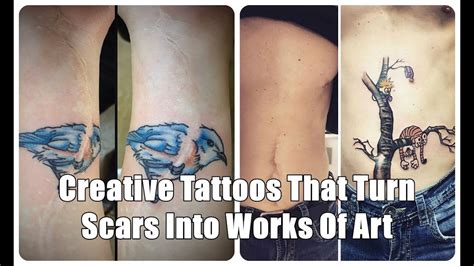 36 Creative Tattoos That Turn Scars Into Works Of Art Youtube