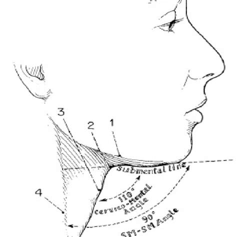 Pdf Management Of The Cervicomental Angle