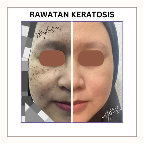 Dr Lyna Klinik Kulit Estetik Aesthetic Kota Bharu Kelantan Klinik