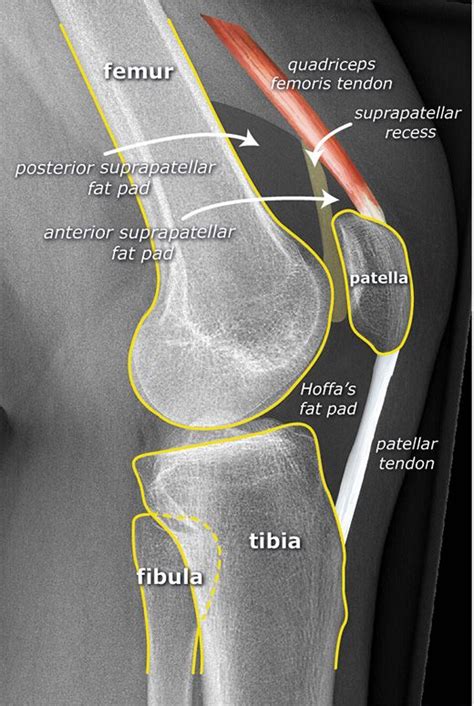 Lateral Image Mediolateral Projection Of The Left Knee Normal