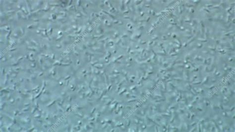E Coli Bacteria Microscopy Stock Video Clip K0069605 Science