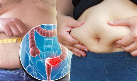 Main symptoms of stomach cancer. Stomach bloating could be symptom of ovarian, bowel or ...