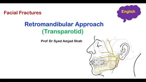 Retromandibular Approach Transparotid Oral And Maxillofacial Surgery Syed Amjad Shah Youtube