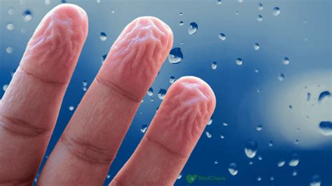 Why Do Our Fingers Get Wrinkly In The Water Medclique