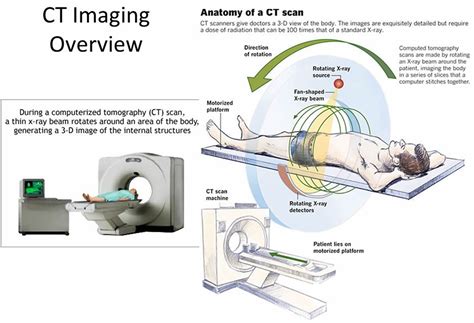 What Are Ct Scans And How Do They Work Omega Pds