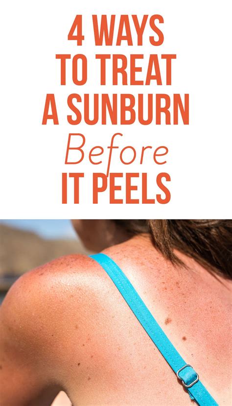 4 ways to treat a sunburn before it peels so you can keep your tan sunburn peeling sunburn