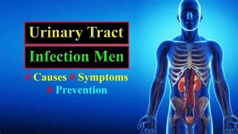 Urinary Tract Infection In Men Causes Symptoms And Treatment Yencomgh