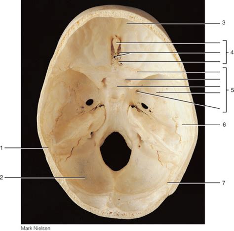 Floor Of Cranial Cavity Labeled