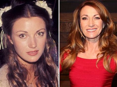 Jane Seymour Before And After Plastic Surgery 2 Celebrity Plastic
