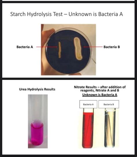 Bacillus Cereus And E Coli Starch Hydrolysis Test Microbiology My XXX Hot Girl