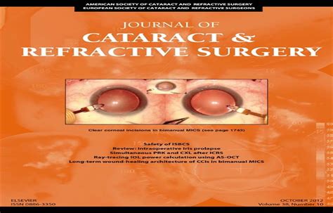 Immediate Sequential Bilateral Cataract Surgery Journal Of Cataract And Refractive Surgery