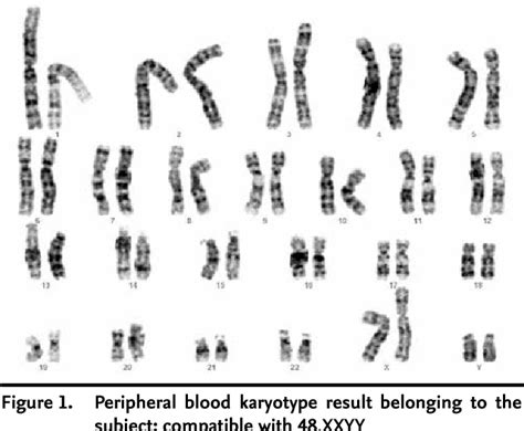Syndrome Xxyy Unique The Rare Chromosome Disorder Support
