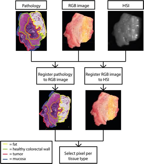Registration Of The Hsi Rgb And Pathology Images In The Upper Row