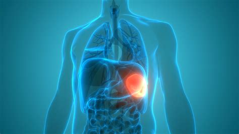 What Is Splenomegaly Enlarged Spleen Symptoms And Causes Goodrx